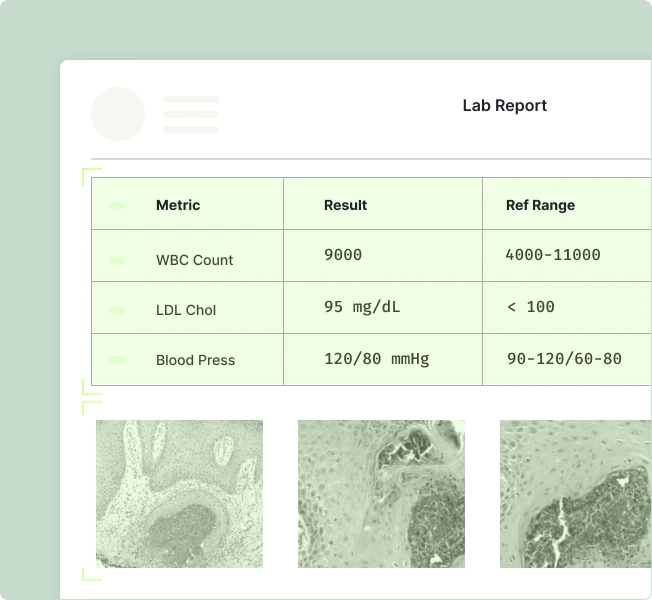 Landing Ai use case example